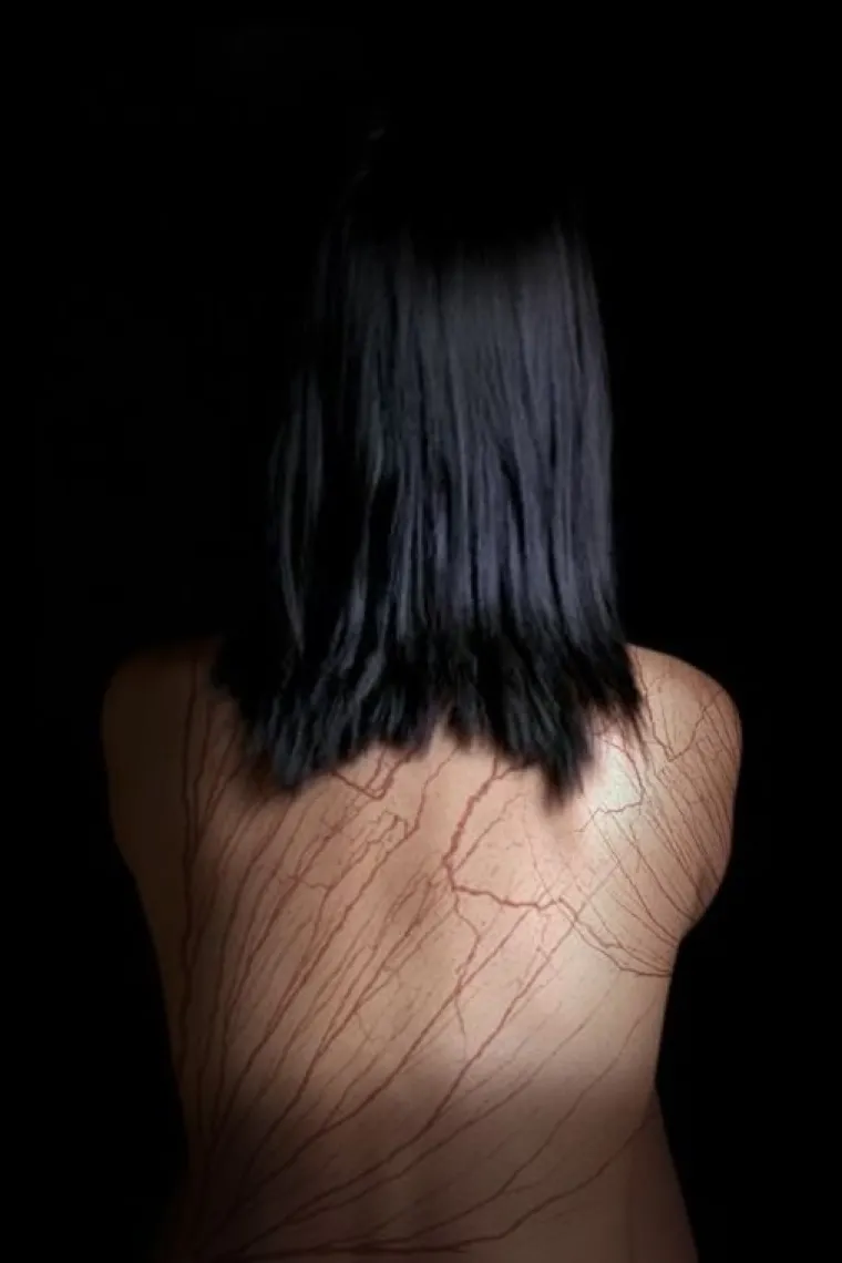 EVO KAKO IZGLEDA KAD VAS UDARI GROM: Ako ne znate &scaron;to su Lichtenbergove figure, možda bolje da tako i ostane