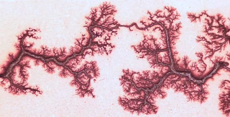 EVO KAKO IZGLEDA KAD VAS UDARI GROM: Ako ne znate &scaron;to su Lichtenbergove figure, možda bolje da tako i ostane