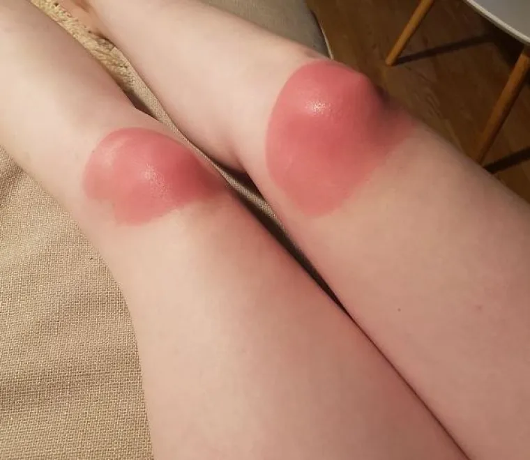 Ako mislite da imate lo&scaron; dan, pogledajte njih: TOP 20 'bad day' situacija