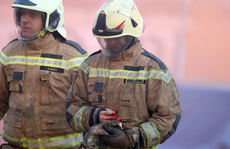 POTRESNE SCENE U SPLITU: Vatrogascu eksplozija topovskog udara otkinula komad prsta!