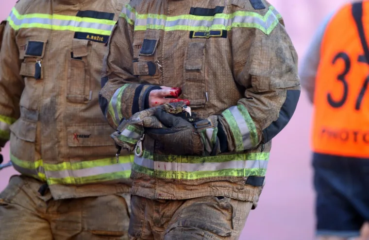 POTRESNE SCENE U SPLITU: Vatrogascu eksplozija topovskog udara otkinula komad prsta!