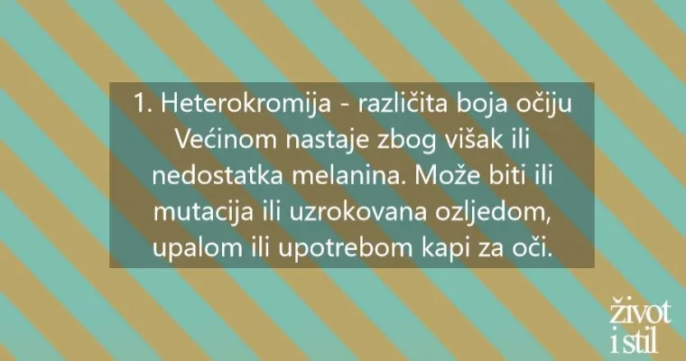 Osam genskih mutacija zbog kojih izgledamo posebno i neuobičajeno