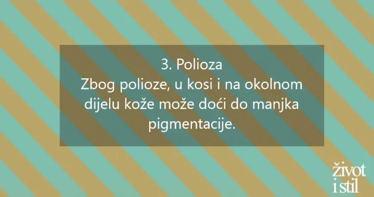 Osam genskih mutacija zbog kojih izgledamo posebno i neuobičajeno