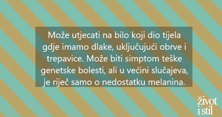 Osam genskih mutacija zbog kojih izgledamo posebno i neuobičajeno