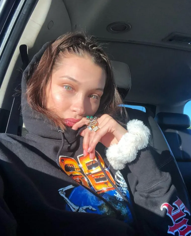 Osam genskih mutacija zbog kojih izgledamo posebno i neuobičajeno