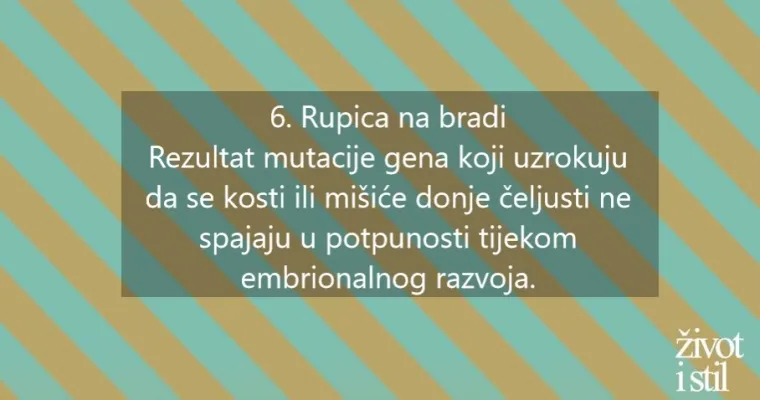Osam genskih mutacija zbog kojih izgledamo posebno i neuobičajeno