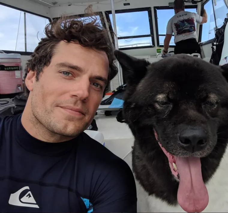 Osam genskih mutacija zbog kojih izgledamo posebno i neuobičajeno