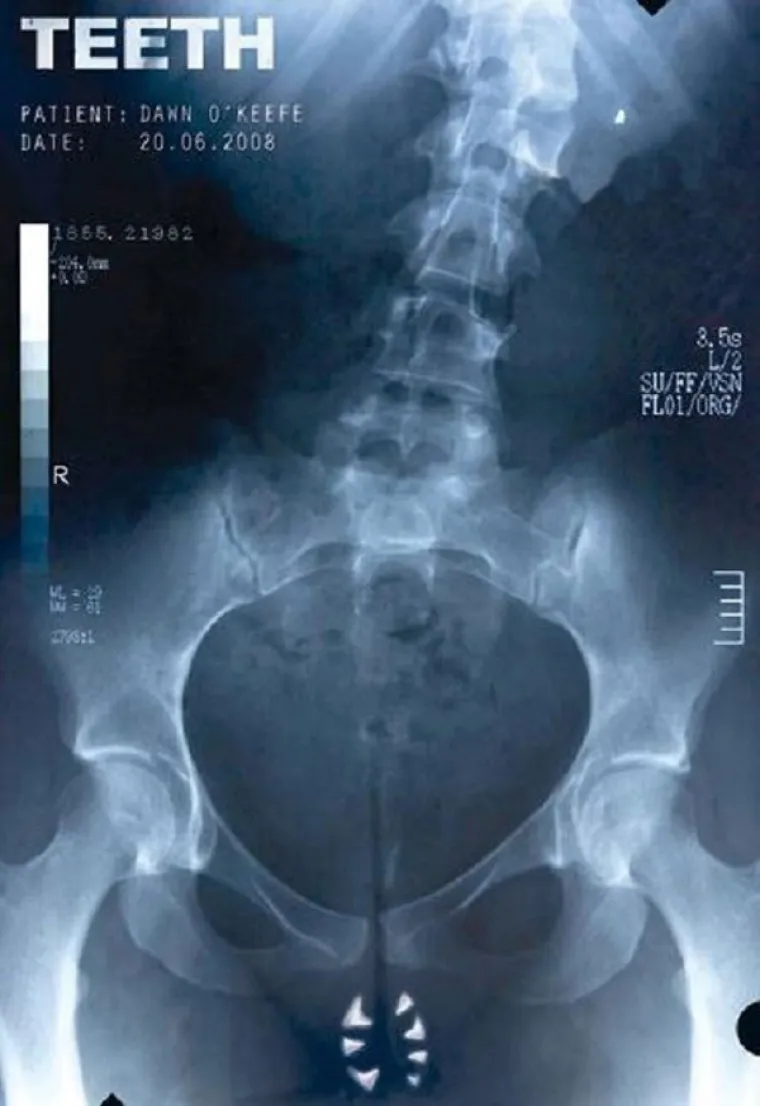 OVI POSTERI SU ZABRANJENI JER SU OTI&Scaron;LI PREDALEKO: Guzice, sperma i razvratni svećenici