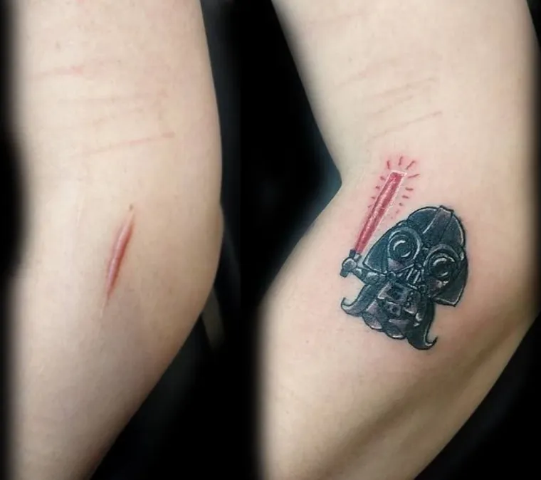 Njihovi ožiljci postali su umjetnost: pogledajte kako fascinantne tetovaže daju novo ruho ožiljcima