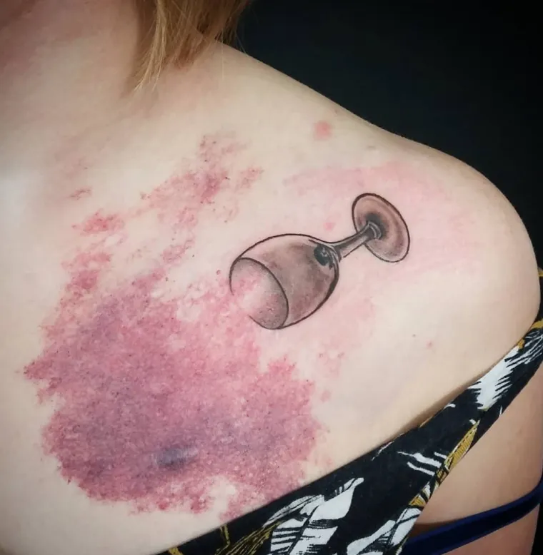 Njihovi ožiljci postali su umjetnost: pogledajte kako fascinantne tetovaže daju novo ruho ožiljcima