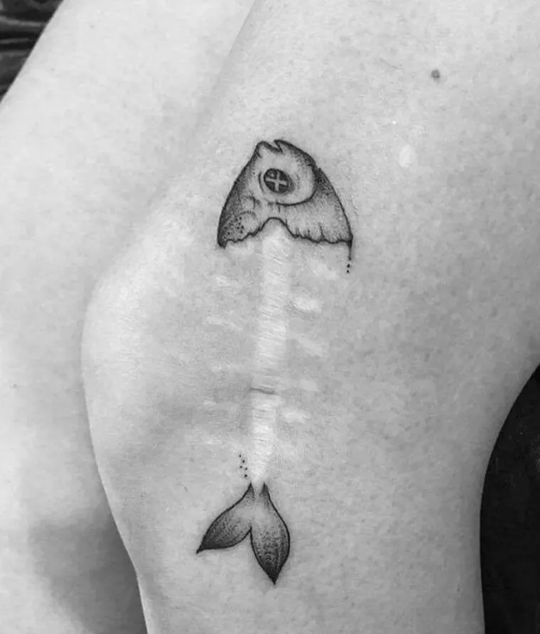 Njihovi ožiljci postali su umjetnost: pogledajte kako fascinantne tetovaže daju novo ruho ožiljcima