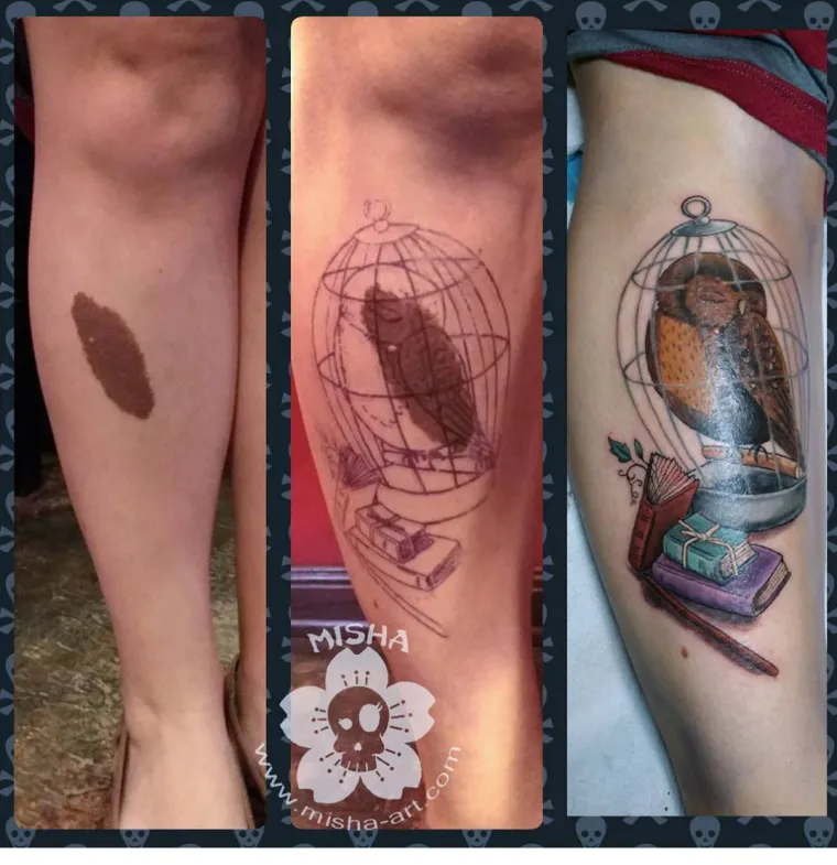 Njihovi ožiljci postali su umjetnost: pogledajte kako fascinantne tetovaže daju novo ruho ožiljcima