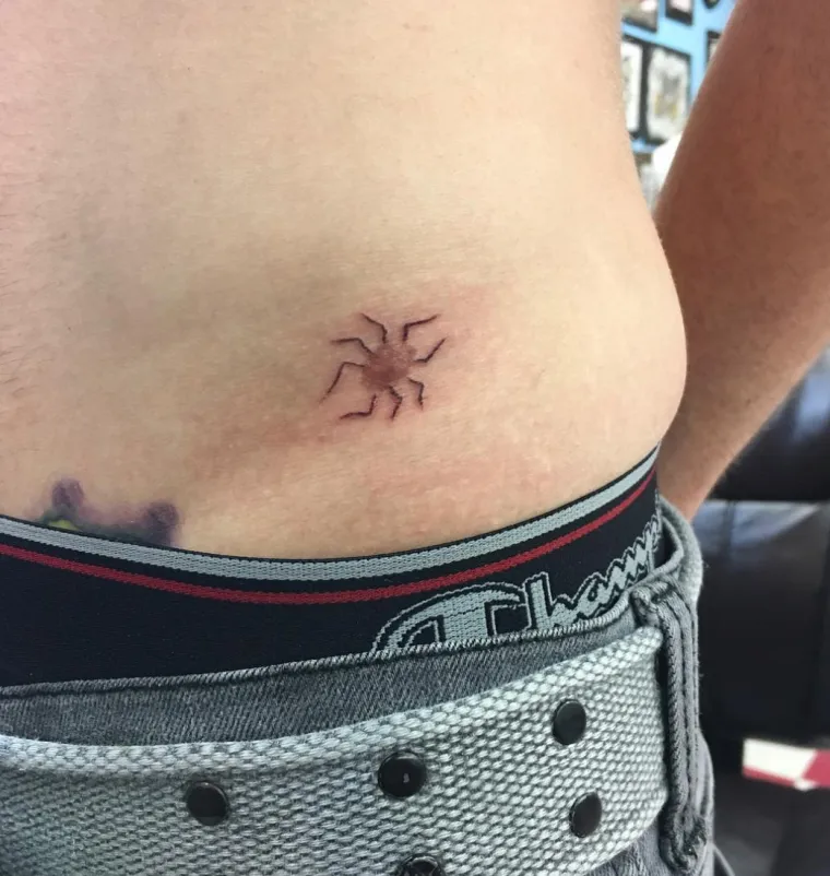 Njihovi ožiljci postali su umjetnost: pogledajte kako fascinantne tetovaže daju novo ruho ožiljcima