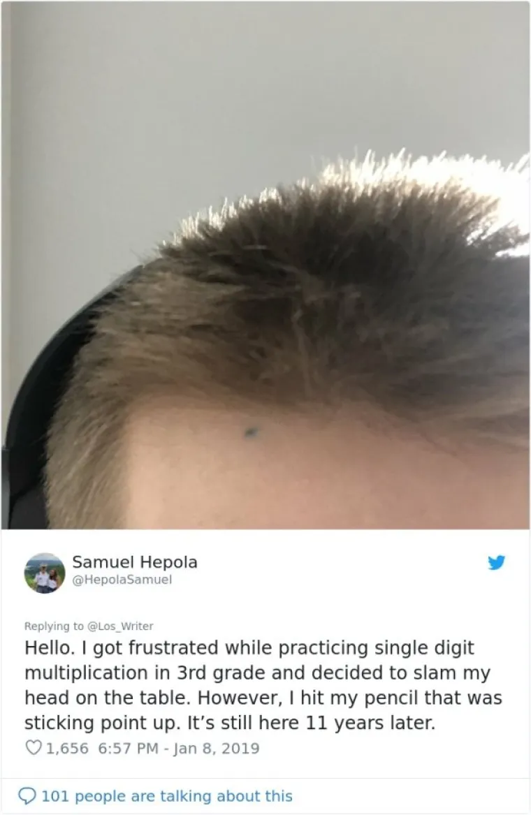 Lik na Twitteru postavio je jednostavno pitanje - jesu li i drugi ostali trajno obilježeni nakon &scaron;to im se vrh olovke zabio u kožu.  I izazvao pravu lavinu komentara, od kojih neki imaju prilično zabavnu priču kako su zaradili tetovažu. 
Frustriralo me vježbanje množenja u trećem razredu i pa sam bacio glavu na stol. No pogodio sam olovku, koja je str&scaron;ala uspravno. Jo&scaron; je ovdje nakon 11 godina