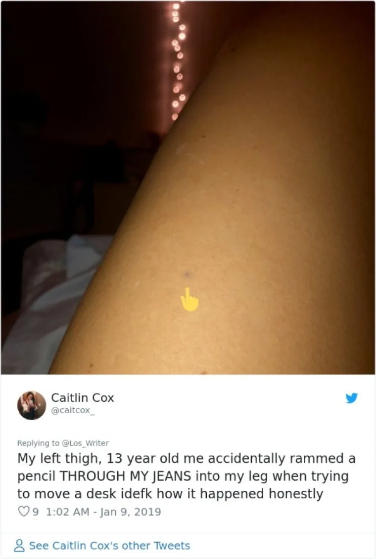 Moje lijevo bedro, 13-godi&scaron;nja ja sam slučajno zabila olovku kroz traperice u nogu kad sam poku&scaron;avala maknuto stol. Ni sama nemam pojma kako se to dogodilo