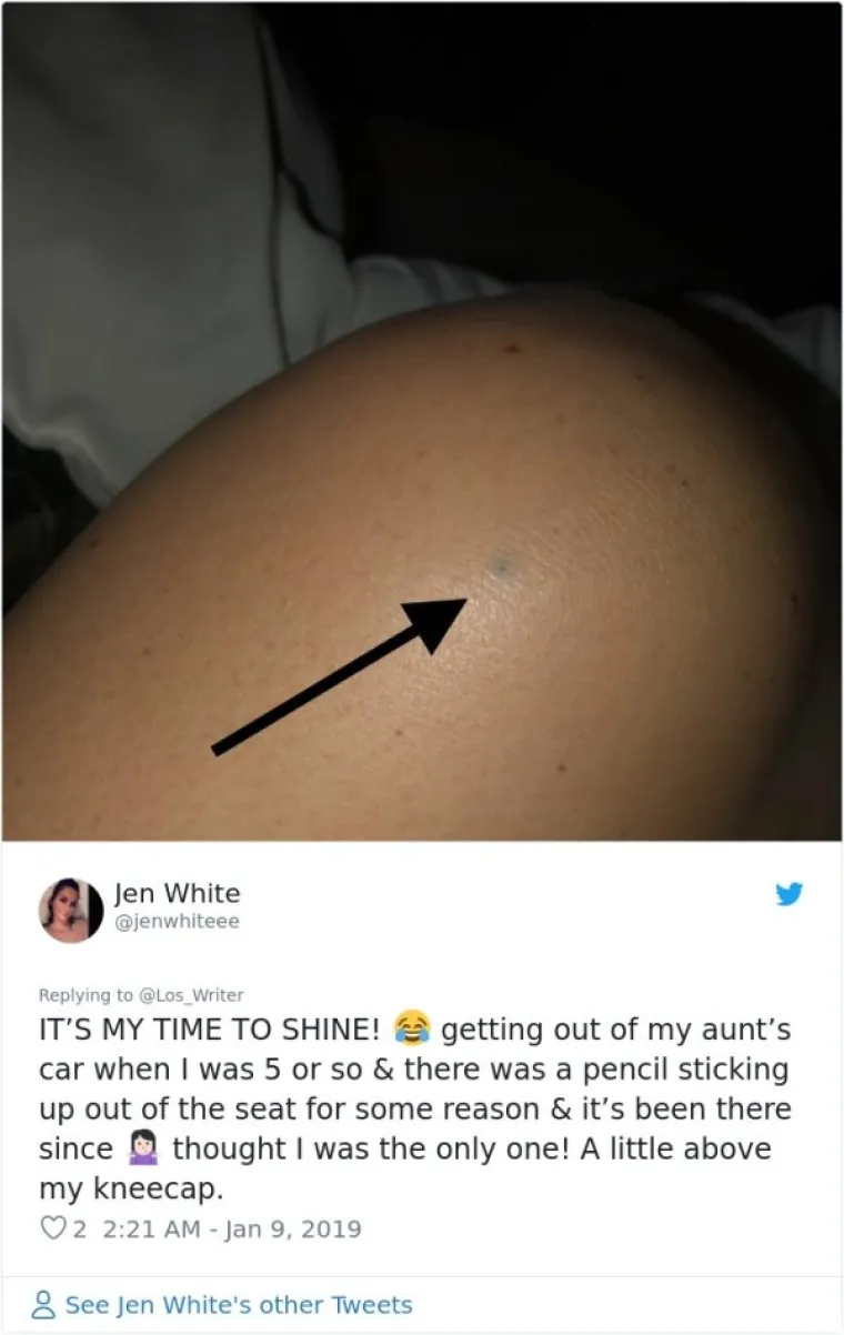 Izlazila sam iz tetinog auta kad sam imala  nekih pet godina. Iz nekog razloga, iz sjedala je str&scaron;ala olovka i tu je od jo&scaron; od tada.. Mislila sam da sam jedina