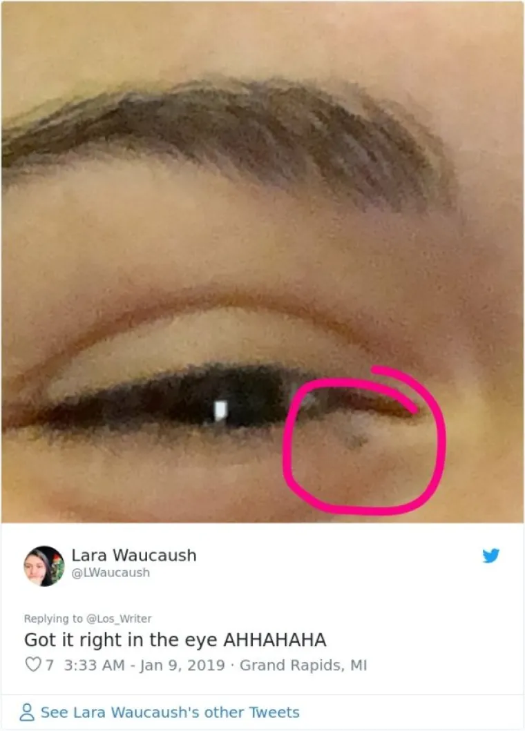 Dobila sam ju ravno u oko