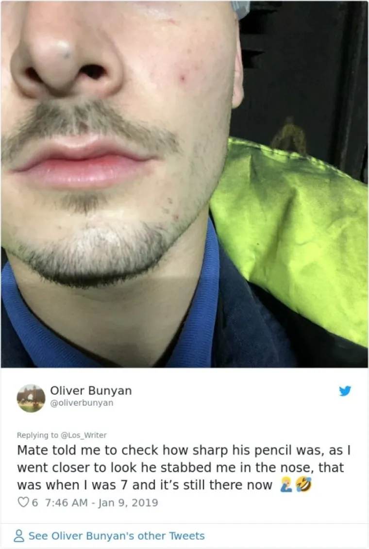 Prijatelj mi rekao da provjerim koliko o&scaron;tra njegova olovka, a kada sam se približio ubo me u nos. Imao sam sedam i jo&scaron; tu stoji