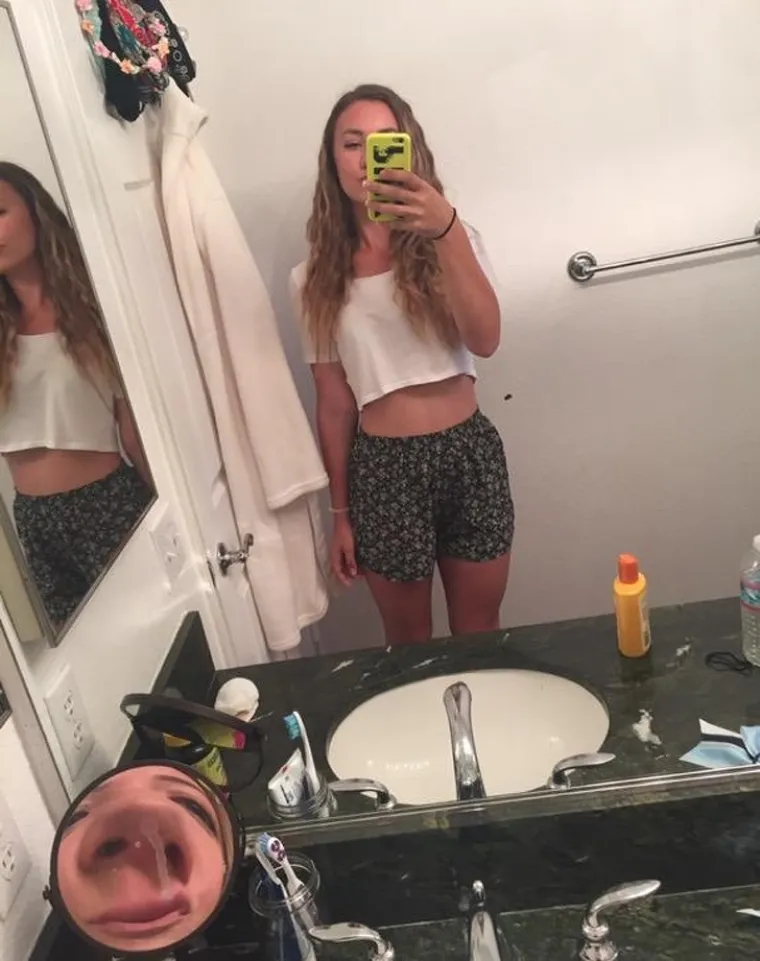 OVDJE JE NEŠTO OPAKO POŠLO PO ZLU: Sigurno znate ljude koji su opsjednuti selfiejima, ali ovo je za psihijatriju