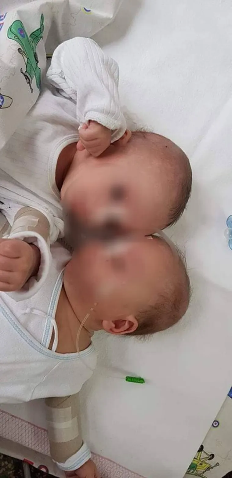 Fotografije beba &scaron;okirale javnost: 'Dijelovi tijela su im žive rane'; ravnateljica kaže: 'Prijete nam smrću'