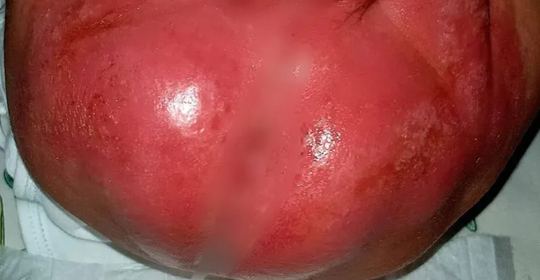 Fotografije beba &scaron;okirale javnost: 'Dijelovi tijela su im žive rane'; ravnateljica kaže: 'Prijete nam smrću'