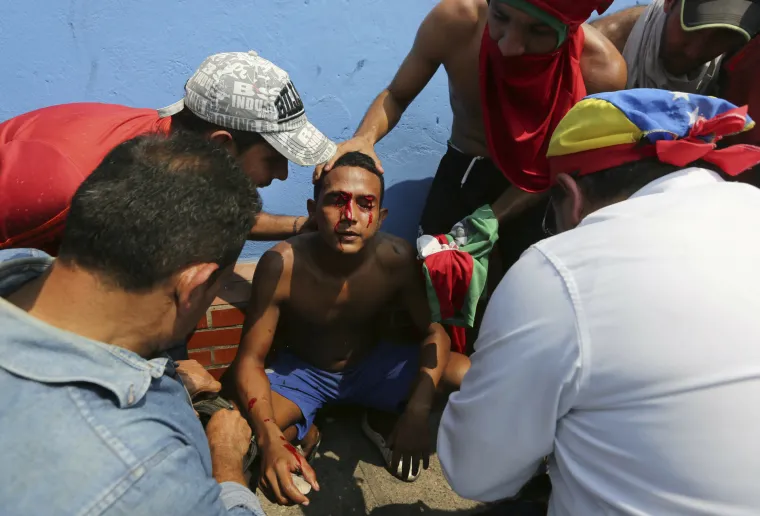 Suzavac i gumeni metci na granici: Maduro prekinuo odnose s Kolumbijom!