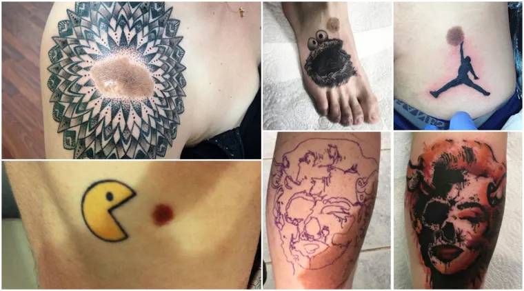 Ovih 20 čudesnih tetovaža sakrivaju nesavr&scaron;enosti na najljep&scaron;i način!