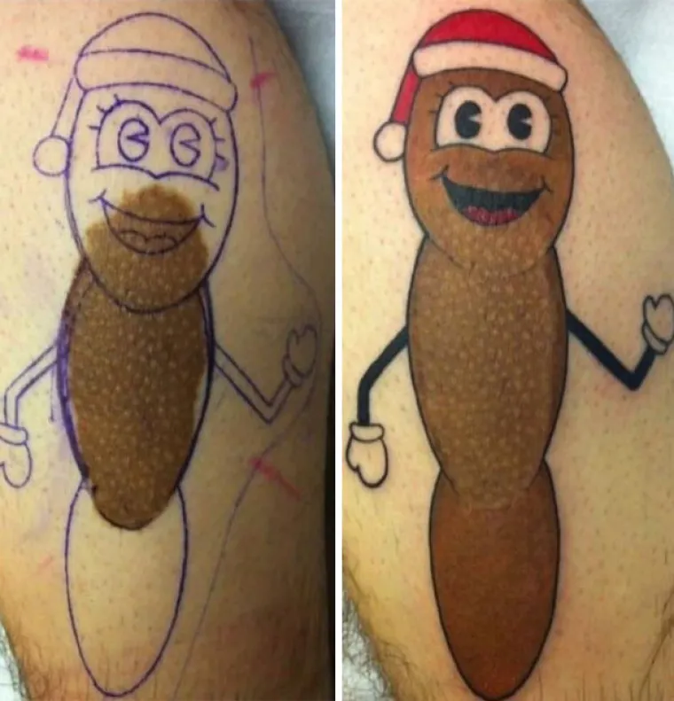 Ovih 20 čudesnih tetovaža sakrivaju nesavr&scaron;enosti na najljep&scaron;i način!