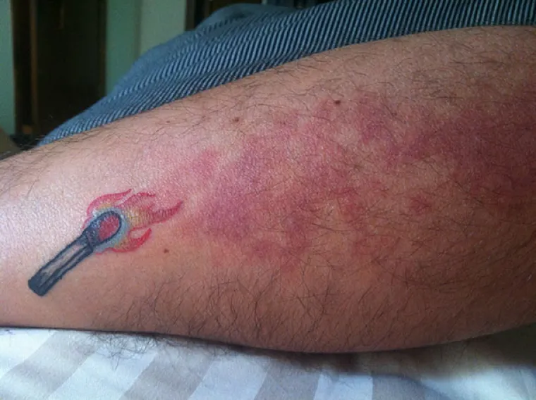 Ovih 20 čudesnih tetovaža sakrivaju nesavr&scaron;enosti na najljep&scaron;i način!