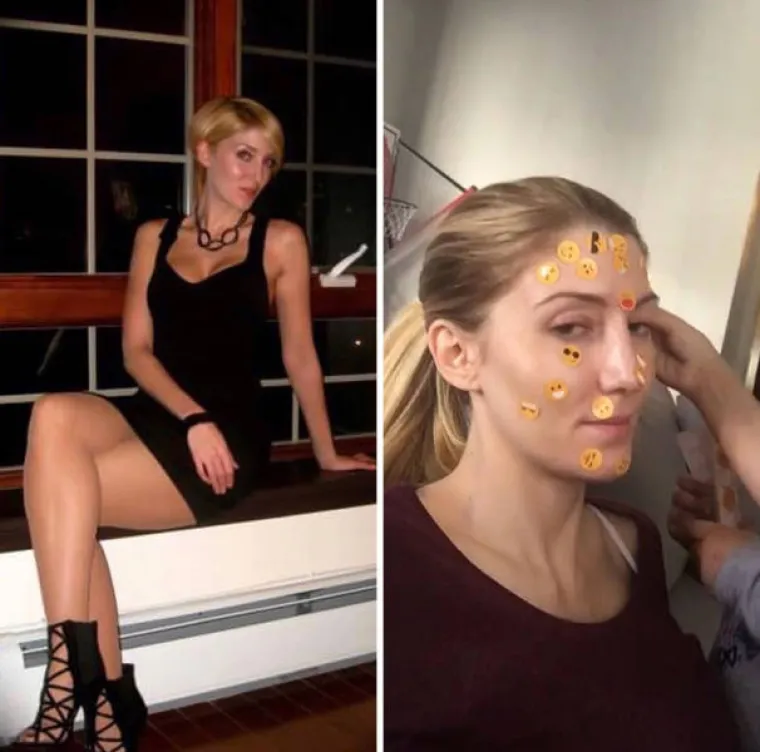 Objavili slike prije i nakon &scaron;to su postali roditelji: &Scaron;to reći? Sada su neprepoznatljivi...