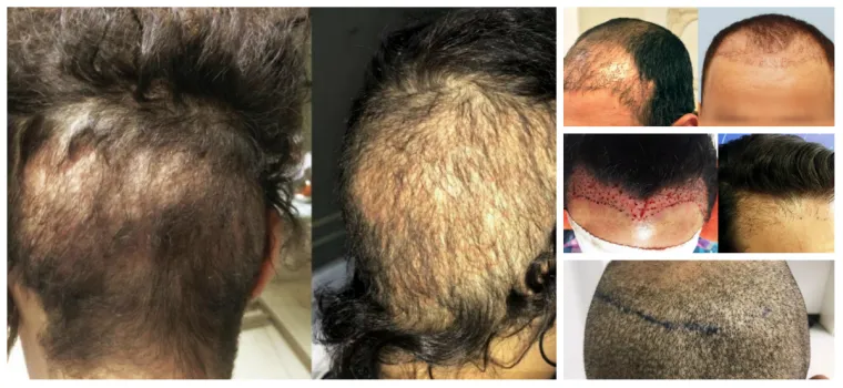 UZNEMIRUJUĆE Htjeli su proći jeftinije, pa su ih unakazili: Katastrofalne gre&scaron;ke ilegalnih liječnika