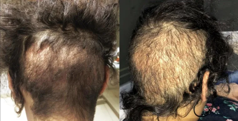 UZNEMIRUJUĆE Htjeli su proći jeftinije, pa su ih unakazili: Katastrofalne gre&scaron;ke ilegalnih liječnika