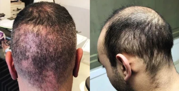 UZNEMIRUJUĆE Htjeli su proći jeftinije, pa su ih unakazili: Katastrofalne gre&scaron;ke ilegalnih liječnika