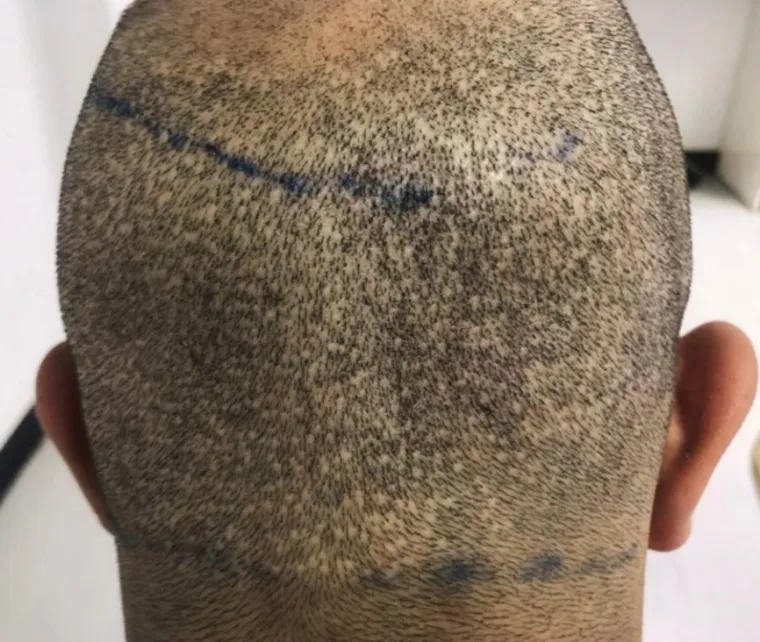 UZNEMIRUJUĆE Htjeli su proći jeftinije, pa su ih unakazili: Katastrofalne gre&scaron;ke ilegalnih liječnika