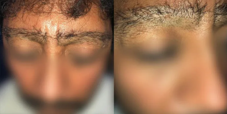 UZNEMIRUJUĆE Htjeli su proći jeftinije, pa su ih unakazili: Katastrofalne gre&scaron;ke ilegalnih liječnika