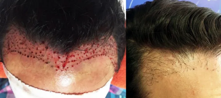 UZNEMIRUJUĆE Htjeli su proći jeftinije, pa su ih unakazili: Katastrofalne gre&scaron;ke ilegalnih liječnika