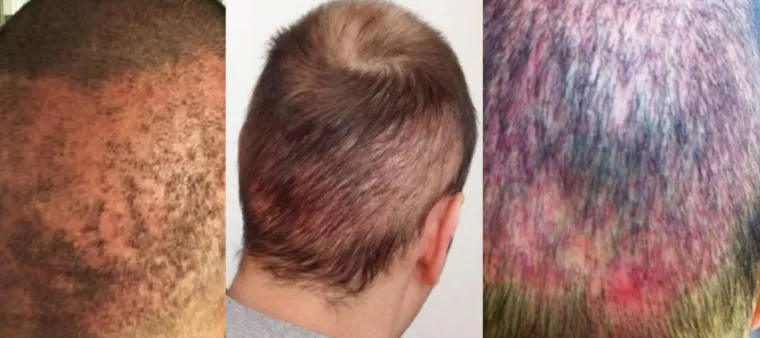 UZNEMIRUJUĆE Htjeli su proći jeftinije, pa su ih unakazili: Katastrofalne gre&scaron;ke ilegalnih liječnika