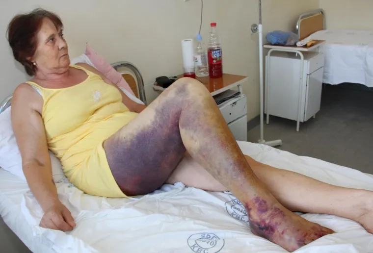 U Hrvatskoj živi 15 različitih vrsta zmija, no samo su dvije opasne za čovjeka - poskok i riđovka. Otrov je smrtonosan. Može narasti do 90 centimetara, ima trokutastu, plosnatu glavu i ro&scaron;čić na vrhu nju&scaron;ke. Na leđima imaju tamnu cik-cak liniju, a boja gornjeg dijela tijela im se mijenja pa može biti siva, žuta ili smeđa.