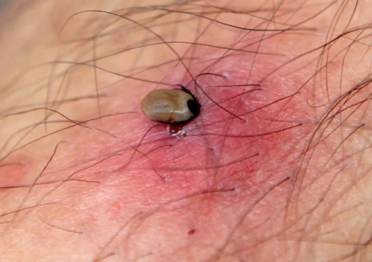 U Hrvatskoj se ugrizom krpelja najče&scaron;će prenose borelioza (lajmska bolest, eritema migrans), krpeljni meningoencefalitis, tularemija, erlihioza, babezioza i neke rikecioze. Preporuča se primjena repelenata, sredstava za odbijanje insekata prije svakog odlaska u prirodu, a osobito u endemska područja gdje se zna da ima zaraženih krpelja. Svaki ugriz krpelja može biti potencijalno koban, ali to može biti čak i prvi, ali i stoti ugriz.