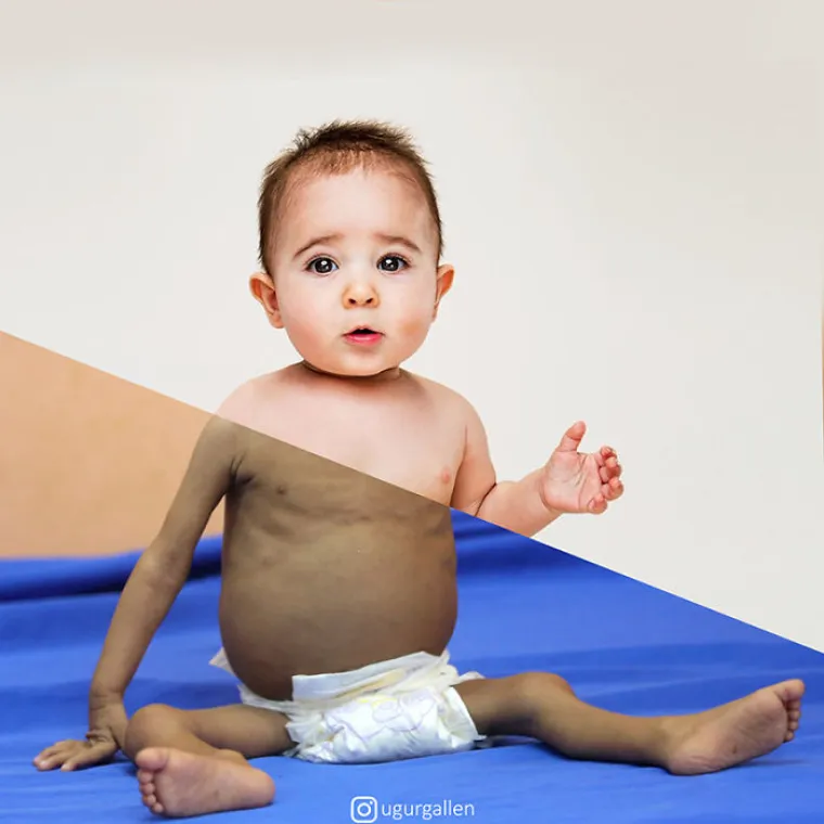 30 slika koje prikazuju kontrast između na&scaron;eg svijeta punog blagostanja i svijeta punog rata