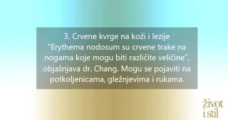 Obratite pažnju: 6 simptoma Crohnove bolesti, a nisu bol u trbuhu