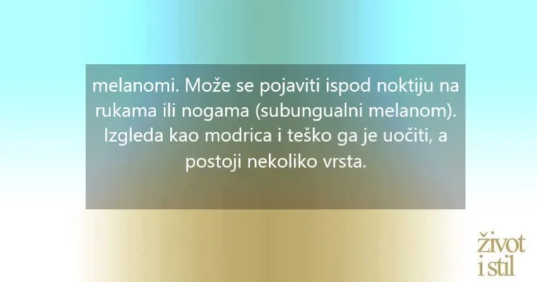7 znakova koji mogu upućivati na melanom