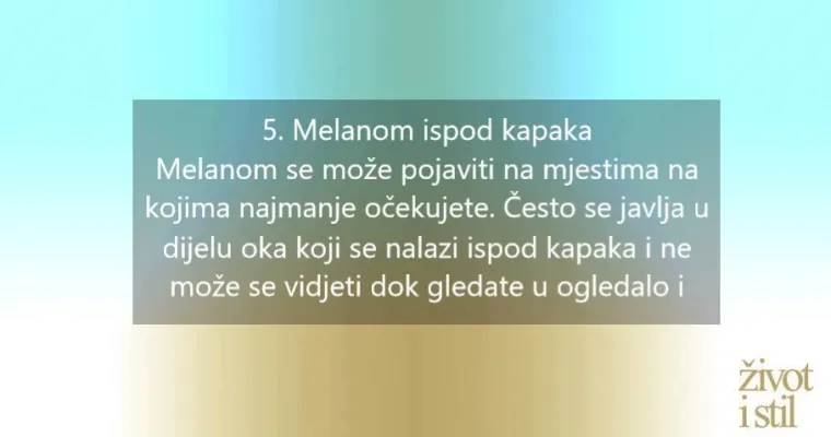 7 znakova koji mogu upućivati na melanom
