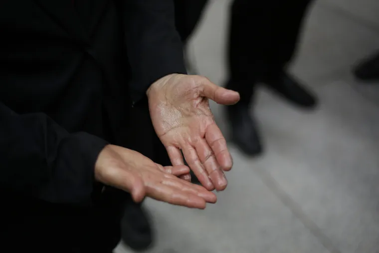 Bizaran prosvjed: Zalijepili se dlanovima da bi poslali ozbiljnu poruku vlasti