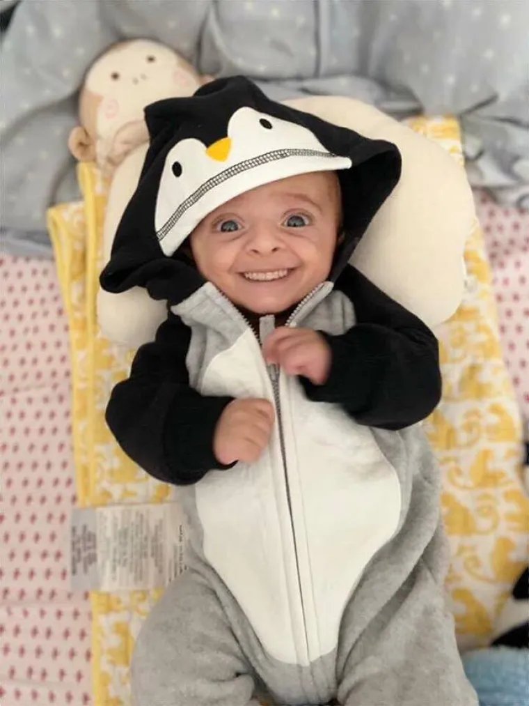 Ove slike beba s zubima odraslih ljudi izgledaju poprilično uznemirujuće