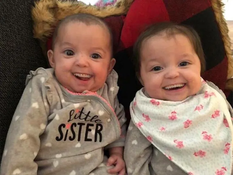 Ove slike beba s zubima odraslih ljudi izgledaju poprilično uznemirujuće