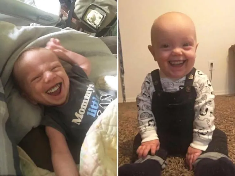 Ove slike beba s zubima odraslih ljudi izgledaju poprilično uznemirujuće