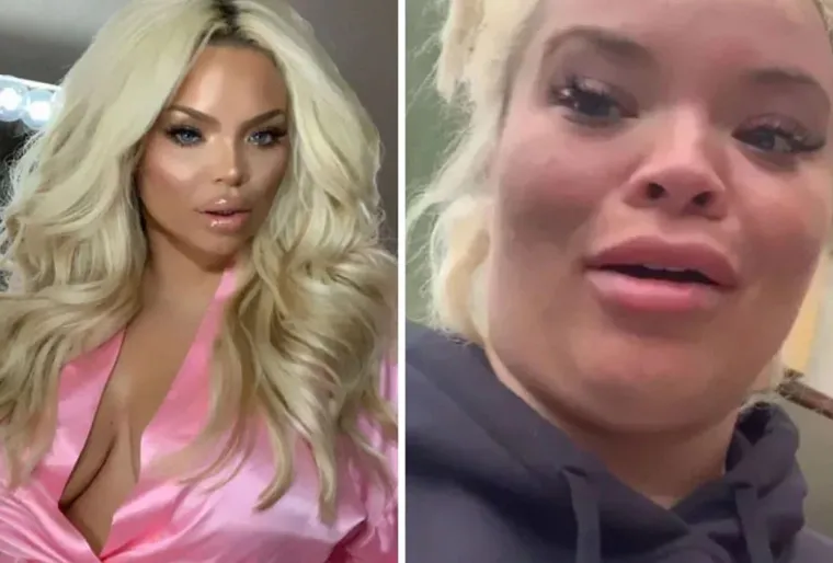 20 fotografija koje dokazuju da 'savr&scaron;eno' tijelo ne postoji i da ne vjerujemo svemu &scaron;to vidimo na Instagramu