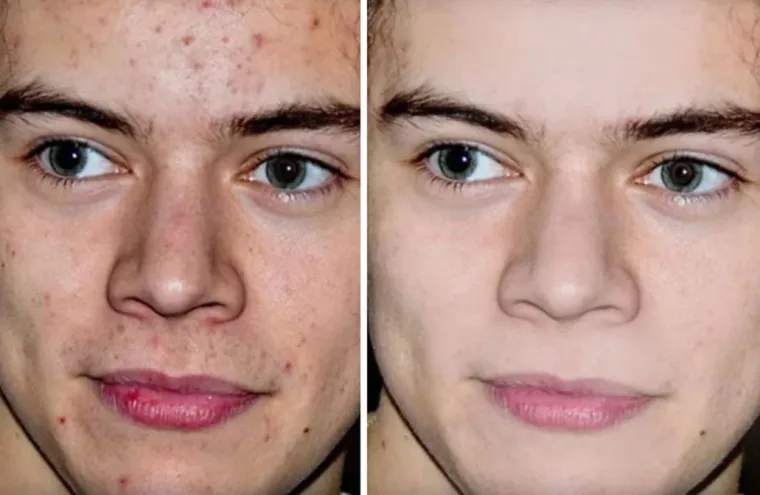 20 fotografija koje dokazuju da 'savr&scaron;eno' tijelo ne postoji i da ne vjerujemo svemu &scaron;to vidimo na Instagramu