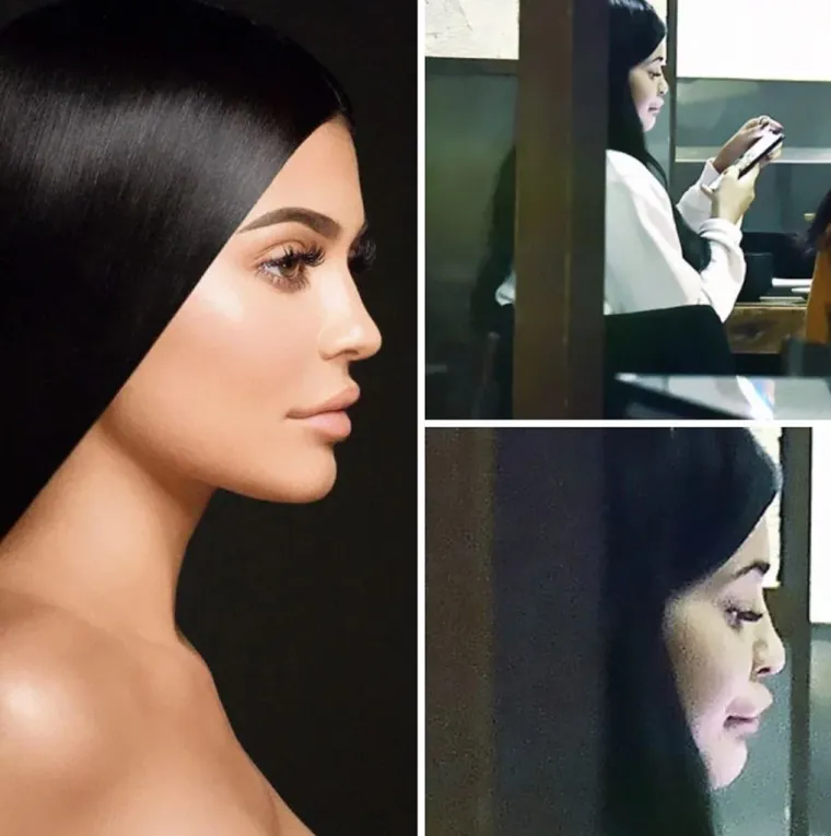 20 fotografija koje dokazuju da 'savr&scaron;eno' tijelo ne postoji i da ne vjerujemo svemu &scaron;to vidimo na Instagramu